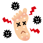 水虫の足裏のイラスト
