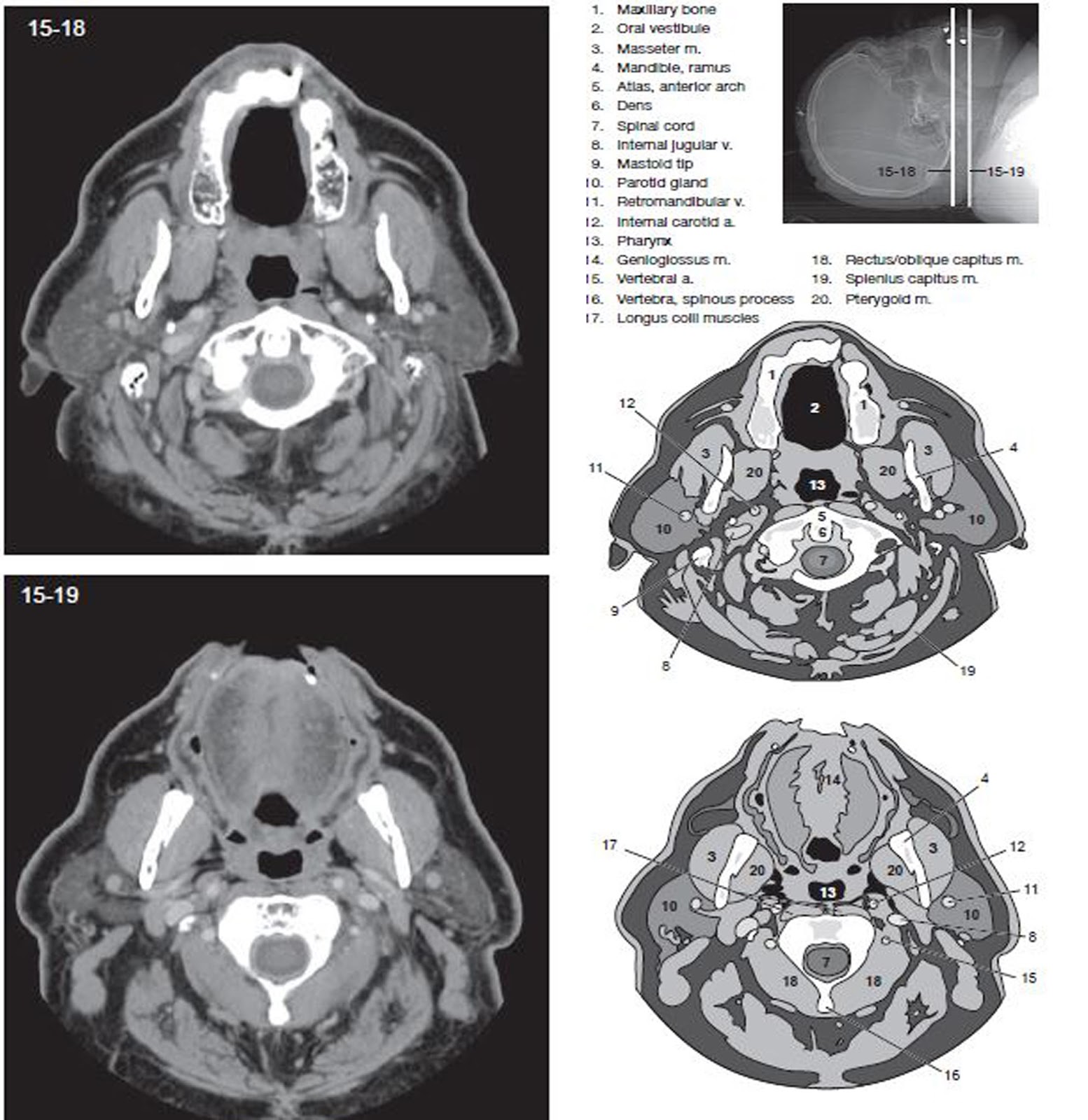30 Label The Ct Scan Of The Neck Labels Design Ideas 2020