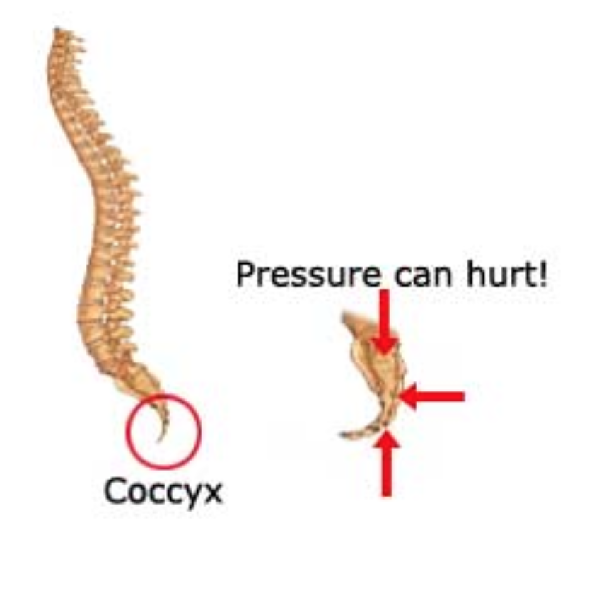 The McMurry Family: Life without a Tailbone