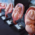 WATCH: Professor Perfectly Articulates The Moral Inconsistency Of ‘Rape Exceptions’ In Abortion Laws
