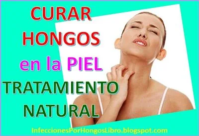 Curar-Hongos-en-la-Piel-Tratamiento-Natural-Remedios-Caseros