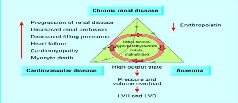 Triad of chronic kidney disease, anemia, and cardiovascular disease 