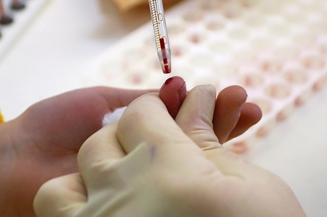 STIs and Oral Sex