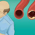 20 Foods That Will Clean Your Arteries Naturally And Protect You From Heart Attacks