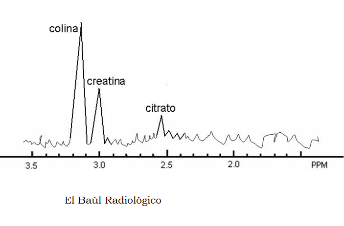 creatina y próstata