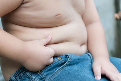 obesity in kids
