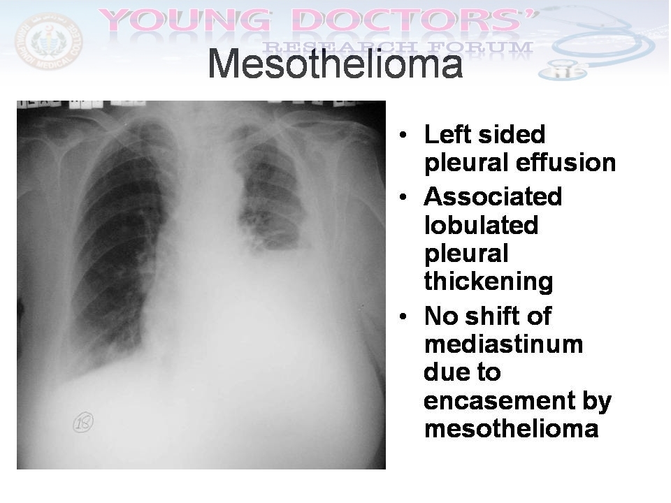 Quick Diagnosis Of The Chest X-Rays (CXR) ~ YOUNG DOCTORS' RESEARCH FORUM
