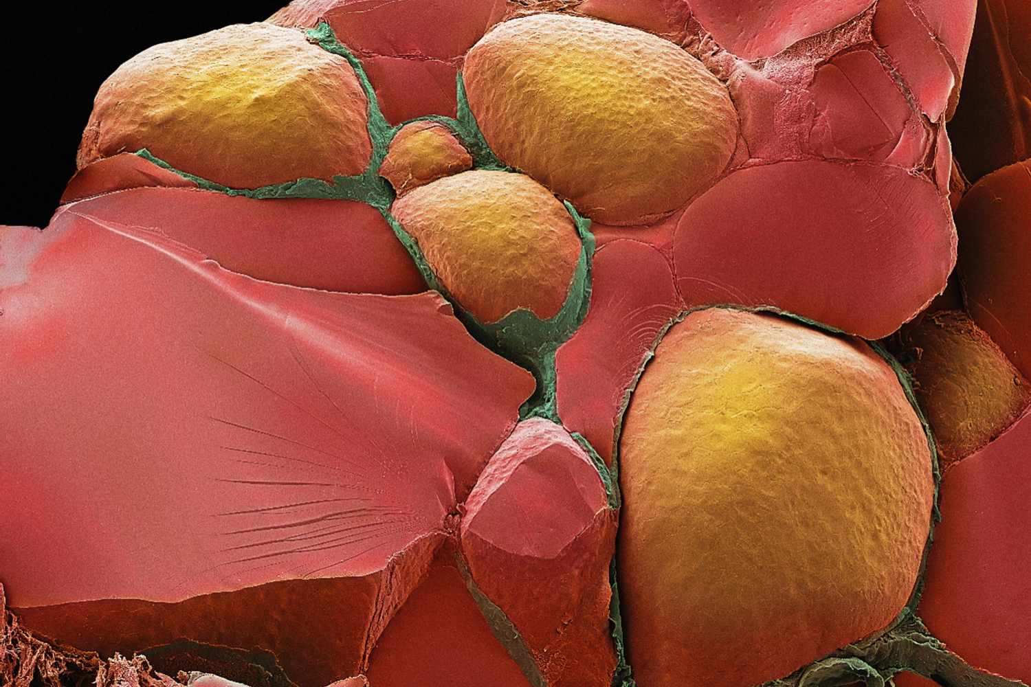 узи картина патологии паращитовидных желез. фолликулы щитовидной железы на узи. строение щитовидной железы гистология. фолликулы щитовидной железы гистология. гипертрофия паращитовидной железы узи.