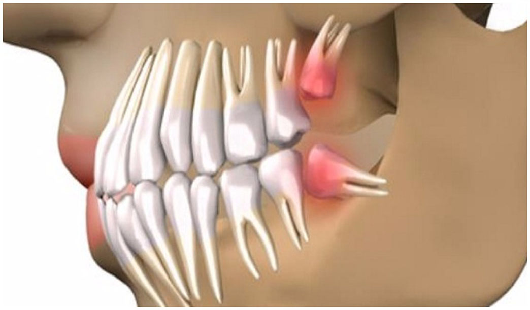 Revolutionary Discovery: Goodbye Dental Implants, Grow Your Own Teeth In Just 9 Weeks!