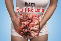 Obat Kutil Kelamin Manjur 100% Jamin Hilang Tuntas