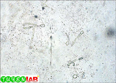 Staining Procedure for Rapid Identification of Fungi | Free Medical Atlas