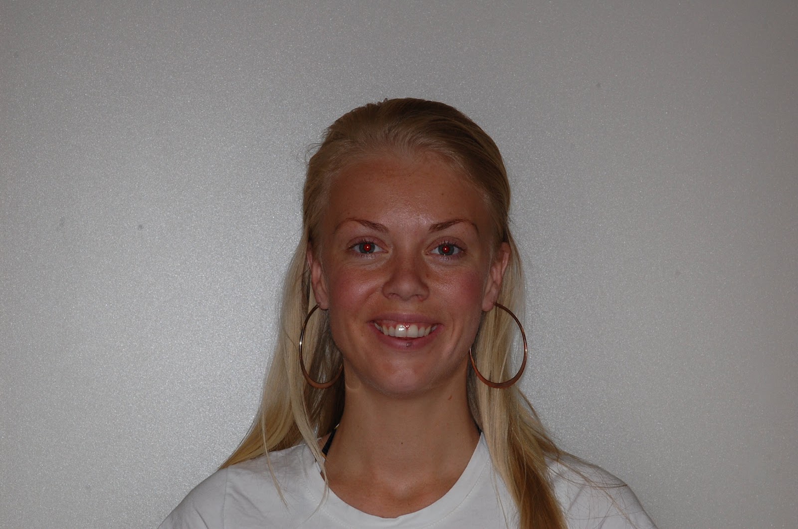 Truman Orthodontics: Orthognathic Surgery