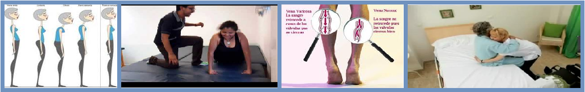 pruebas de fisioterapia para insuficiencia venosa