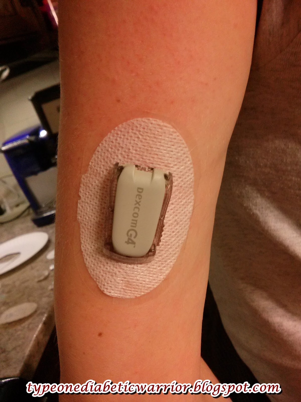 I am a Type 1 Diabetic Warrior Diabetic Warrior and Opsite Flexifix tutorial