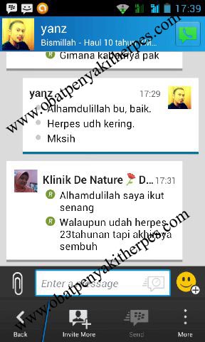 obat herpes manjur