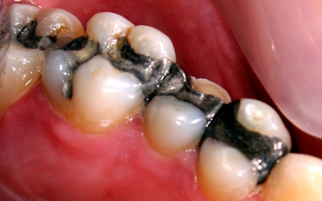 19 Τρόποι δολοφονικής προσβολής καρκίνου