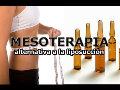 Homeopatia para adelgazar en neuquensaurus