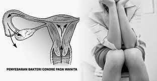 Obat Bagi Wanita Pengidap Kencing Nanah Obat Bagi Wanita Pengidap Kencing Nanah