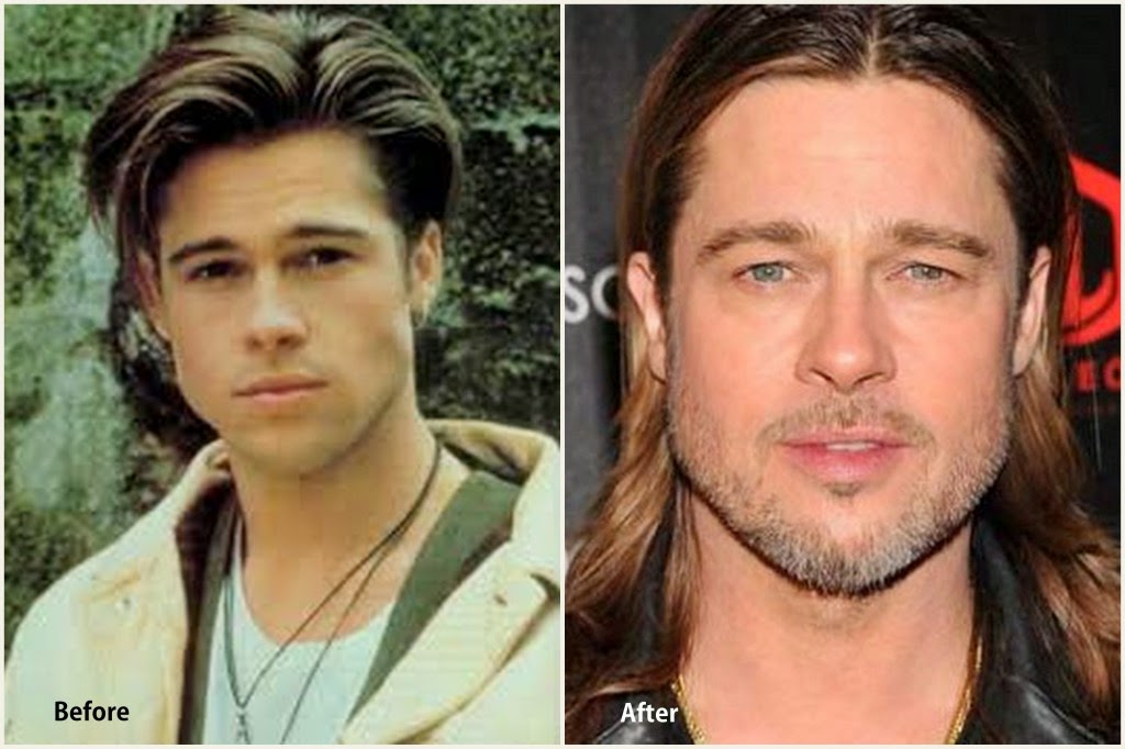 Has Brad Pitt had Plastic Surgery Nose Job Before and After Photos