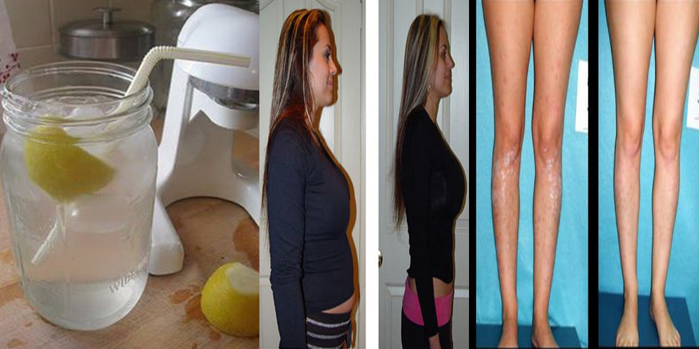 Magical Benefits of Lemon Water For Skin, Hairs and Weight loss Life