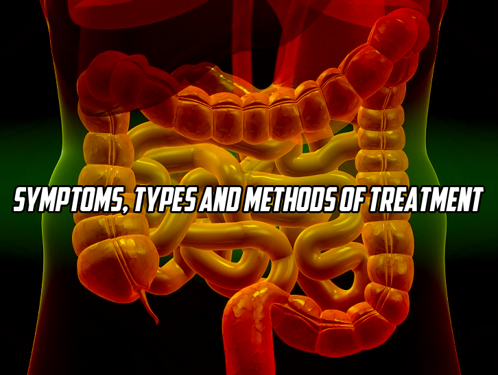 Symptoms, types and methods of treatment - Treatment of diseases ...