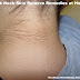 Dark Neck Skin Remove Remedies at Home