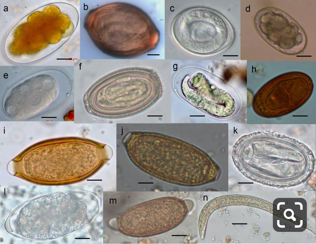 Parasitolog a Prevenci n De Teniasis Neurocisticercosis parasitolog-a-prevenci-n-de-teniasis-neurocisticercosis