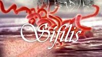 Obat Sipilis Primer Herbal pada Pria dan Wanita Tanpa Obat Apotek
