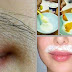 Amazing Methods To Remove Hair From Your Upper Lips Permanently