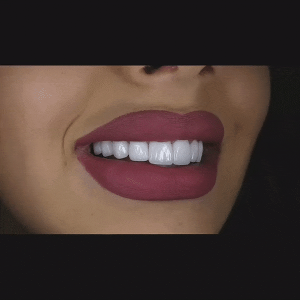 DR.BHAGYA'S DENTAL CARE AND IMPLANT CENTRE ROOT CANAL WITH FIXED