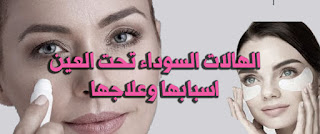 الهالات السوداء تحت العين اسبابها وعلاجها