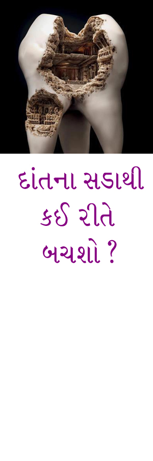  દાંતના સડાથી કઈ રીતે બચશો ?