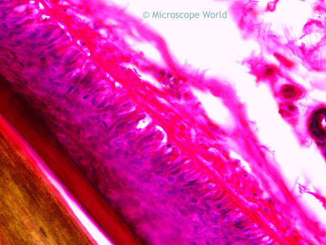 Hair and scalp c.s. captured under the microscope at 100x.