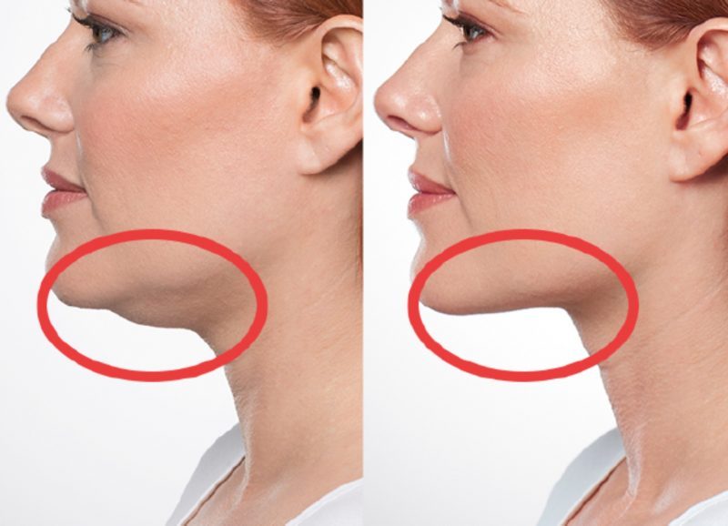 Exercises To Get Rid Of A Double Chin My Favorite Things