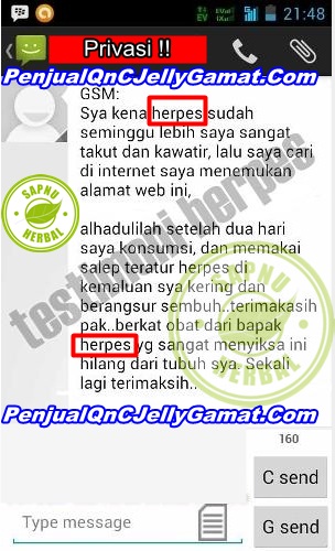Cara Mengobati Eksim Basah Secara Alami Sampai Tuntas Cara Mengobati Eksim Basah Secara Alami Sampai Tuntas