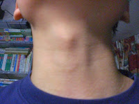Adam's Apple Adam's Apple