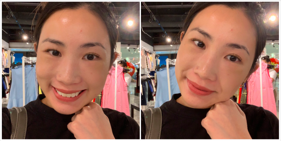 Grace Myu Malaysia Beauty Fashion Lifestyle Blogger Eye Bags Removal Via Accusculpt Laser An Aesthetic Clinic Procedure With Rj Clinic