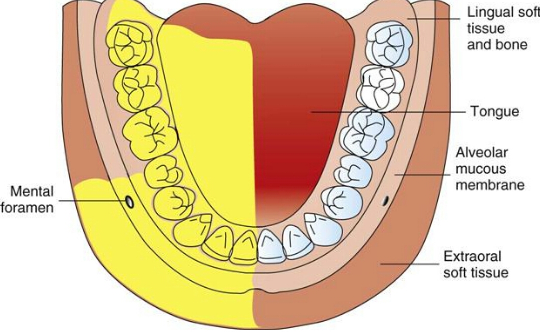 Inferior Alveolar Nerve Block In Children