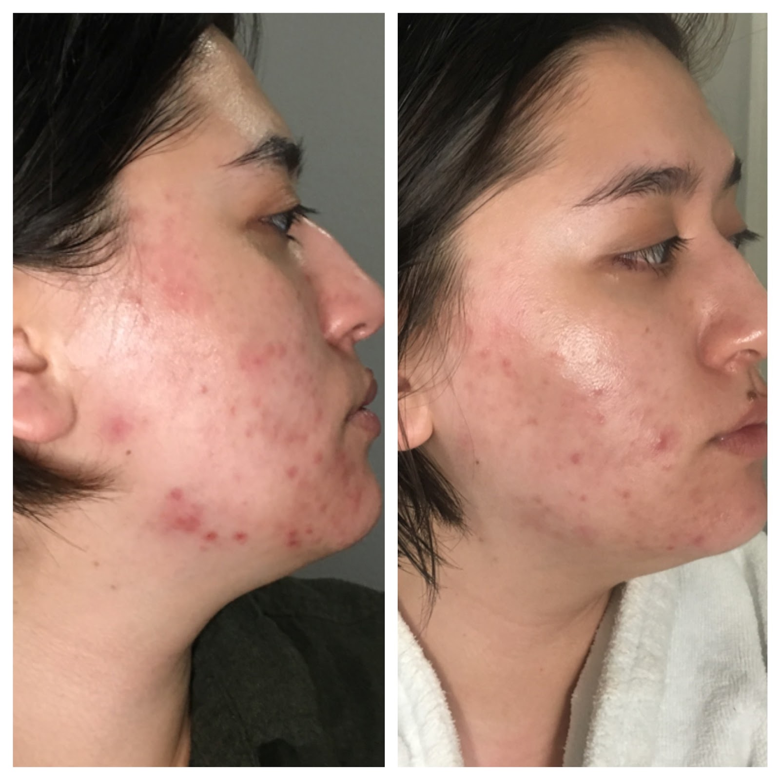 faceonomics-how-i-fixed-my-dehydrated-skin