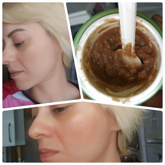 yok olma adim kalker evde likit fondoten yapimi lonegrovedentist com yok olma adim kalker evde likit fondoten yapimi lonegrovedentist com