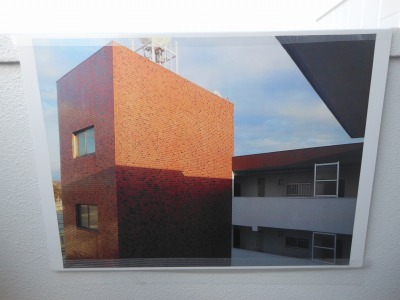 4種類の会陰切開術 会陰切開の4つのタイプとは何ですか?