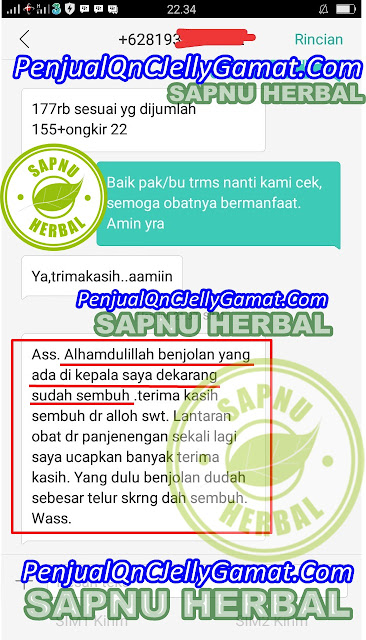 Obat Kelenjar Tiroid Bengkak Manjur Obat Kelenjar Tiroid Bengkak Manjur
