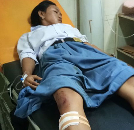 Ayu saat mendapat perawatan medis di rumah sakit. Ayu saat mendapat perawatan medis di rumah sakit.