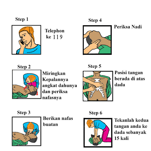 Kenali Ciri-ciri Sakit Jantung Beserta Pencegahannya Agar Dapat Diobati Sejak Awal