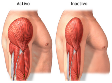 Que es la Artrofia Muscular?
