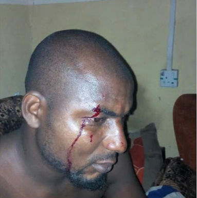 Photos: Member of PDP New Media team in Benue State claims he was attacked by police officers on his sick bed