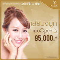 เสริมจมูก แบบโอเพ่น