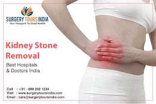 Kidney Stone Removal Treatment in India