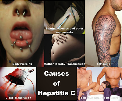 Hepatitis C Risk from Amateur Tattoos and Piercing