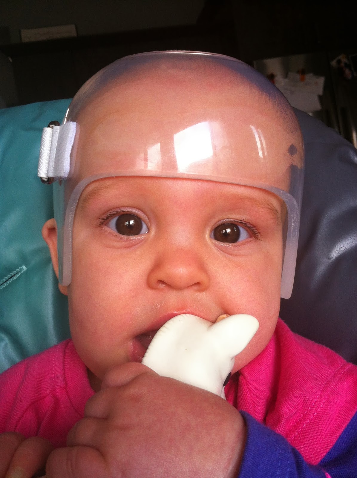 crazily normal Positional Plagiocephaly Part V Rockin' the Band